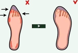 Обувь и заболевания ног